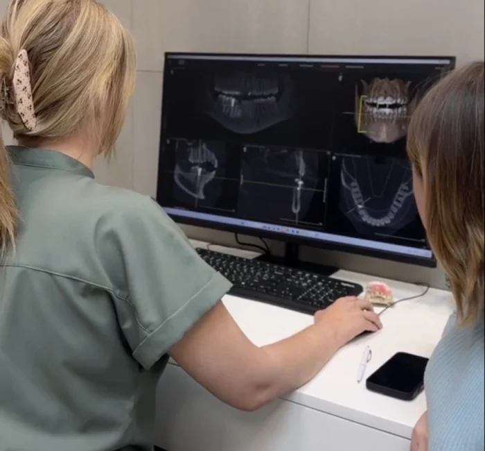 implant-ili-semnyj-protez